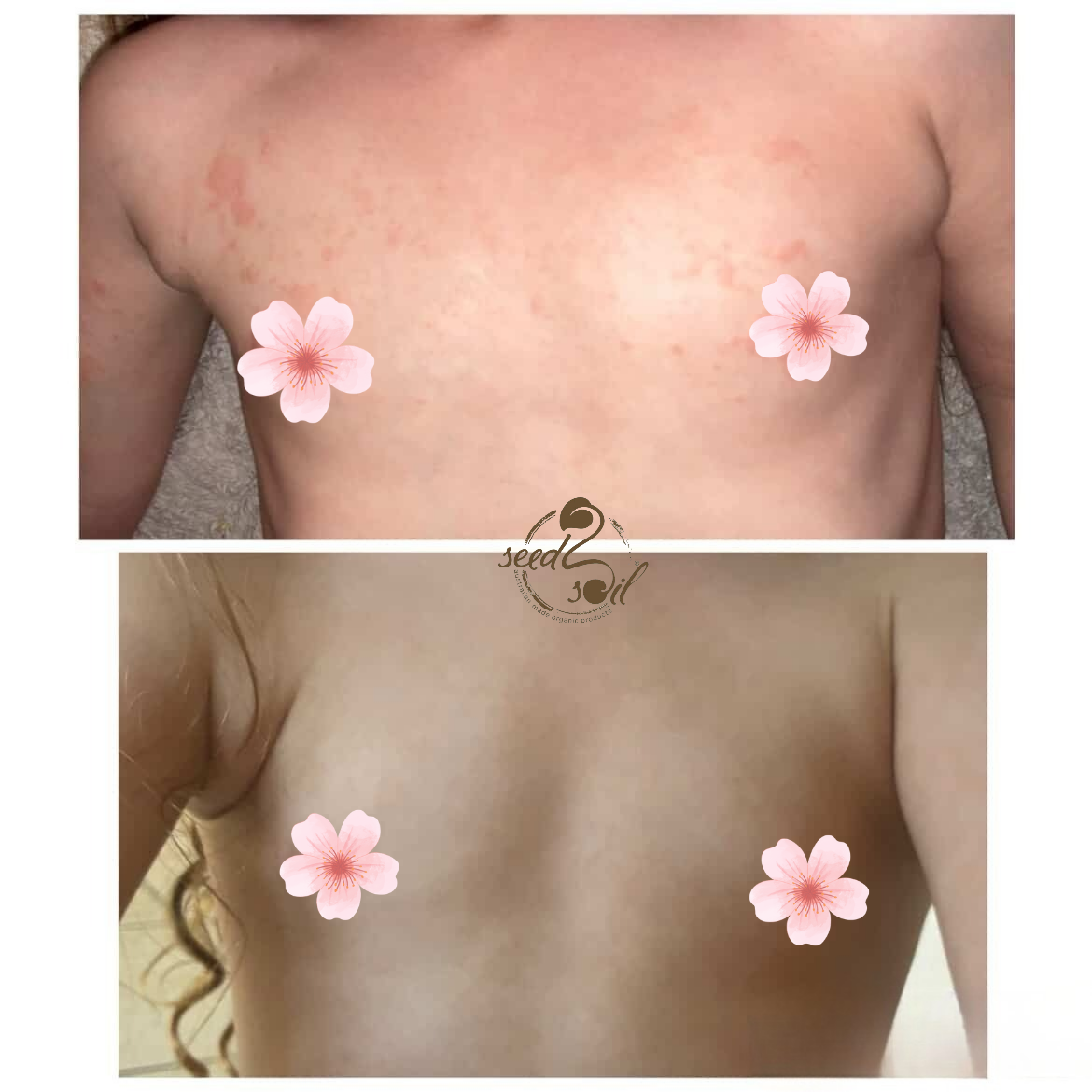 Before & After