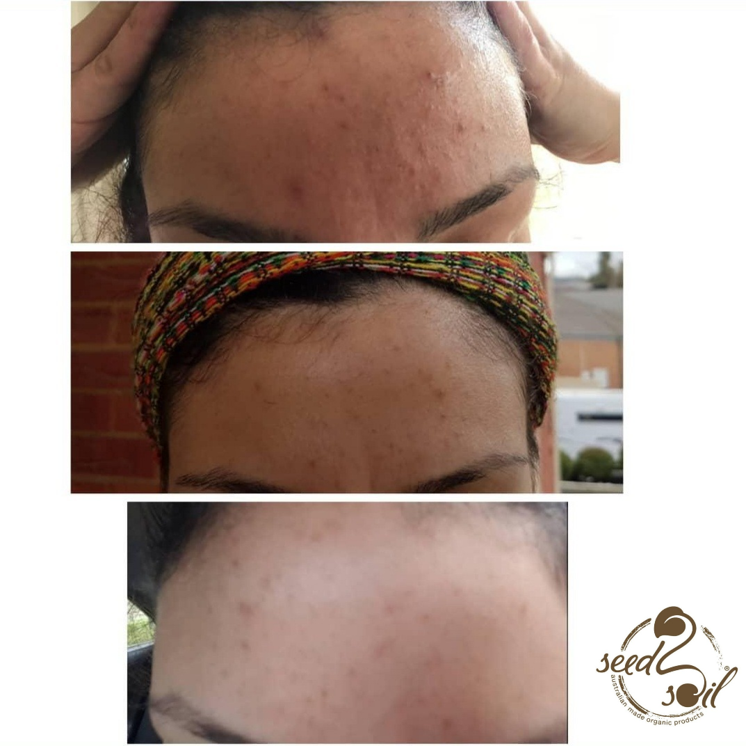 Before & After