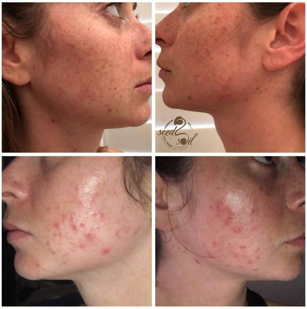 Before & After