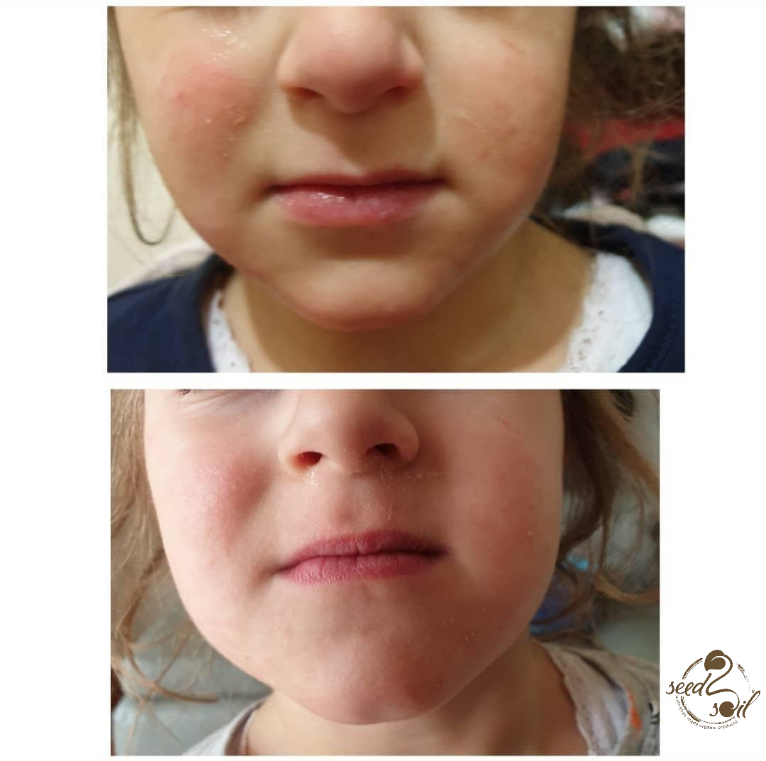 Before & After