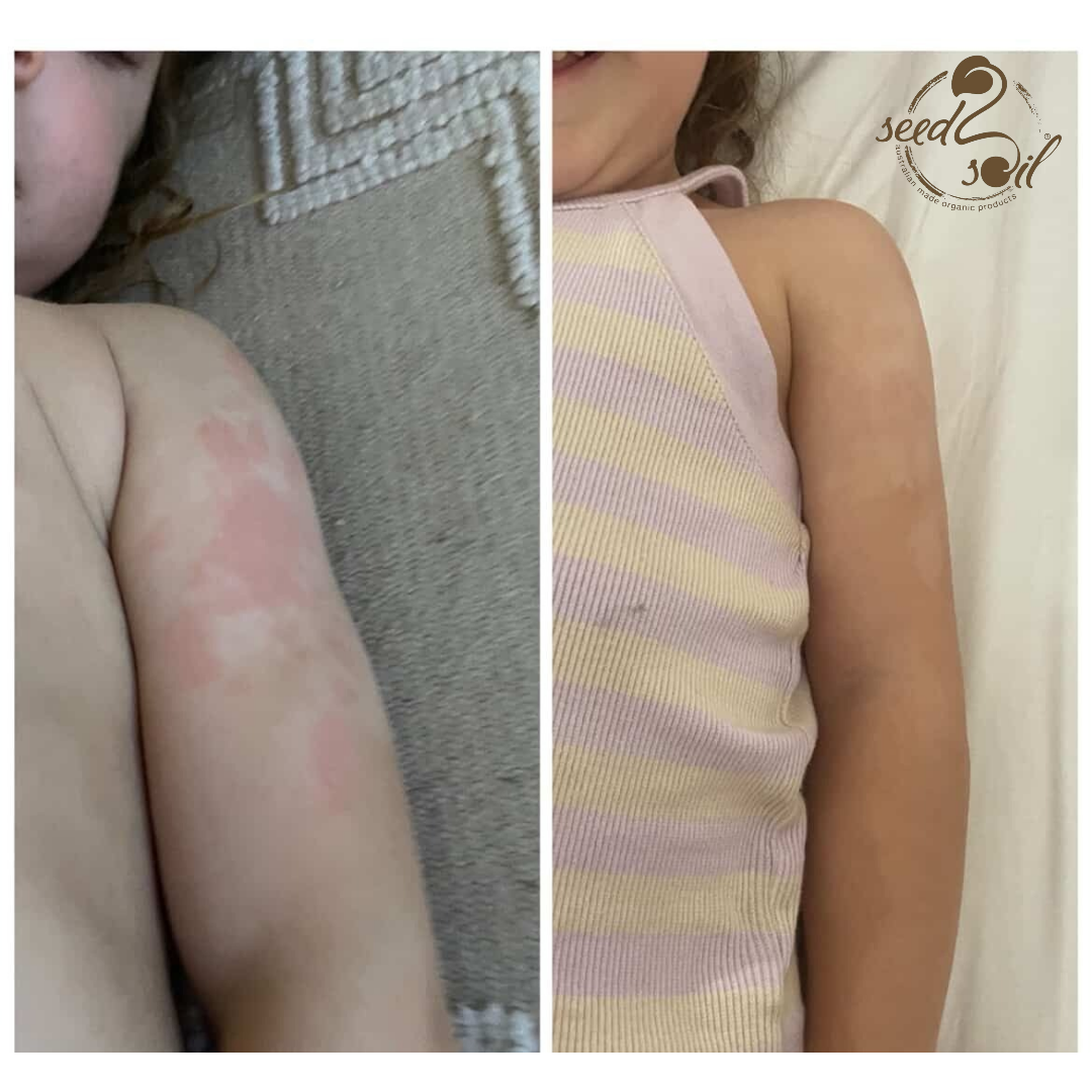 Before & After